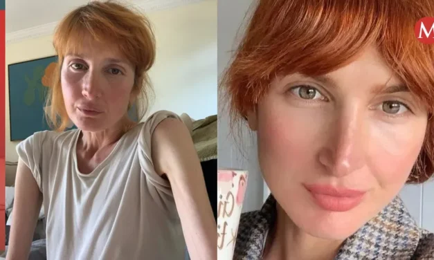 MODELO CON CÁNCER CASI MUERE POR INTENTAR CURARSE CON JUGOS Y NEGARSE A LA QUIMIOTERAPIA